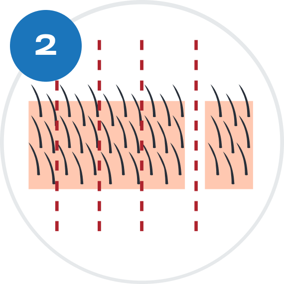 STRIP
SLIVERING